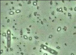 Bacillus thuringiensis